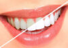 TEETH WHITENING TREATMENT: AT HOME OR AT THE CLINIC? Teeth whitening