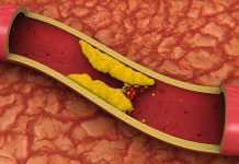 HDL cholesterol levels