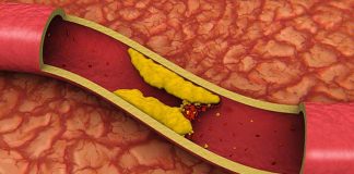 HDL cholesterol levels